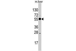 Western blot analysis of ALDH8A1 polyclonal antibody  in mouse liver tissue lysates (35 ug/lane). (ALDH8A1 Antikörper  (C-Term))