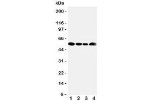 Western blot testing of MCT5 antibody and Lane 1:  rat testis;  2: human Jurkat;  3: (h) HeLa;  4: (h) MCF-7 cell lysate.