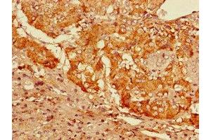 Immunohistochemistry of paraffin-embedded human adrenal gland tissue using ABIN7153725 at dilution of 1:100 (GFRA3 Antikörper  (AA 32-236))