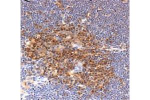 Immunohistochemical staining in mouse thymus with PFN1 polyclonal antibody . (PFN1 Antikörper  (AA 100-140))