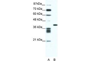 WB Suggested Anti-ALX4 Antibody Titration: 0. (ALX4 Antikörper  (N-Term))