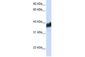 CLN8 antibody used at 1 ug/ml to detect target protein. (CLN8 Antikörper)