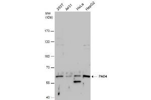 PAD4 Antikörper  (Center)