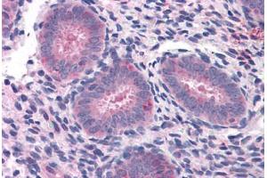 Human Uterus: Formalin-Fixed, Paraffin-Embedded (FFPE) (ELP3/KAT9 Antikörper  (AA 240-445))