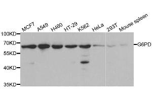 Western blot analysis of extracts of various cell lines, using G6PD antibody. (Glucose-6-Phosphate Dehydrogenase Antikörper  (AA 246-545))