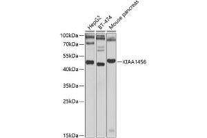 Western blot analysis of extracts of various cell lines, using KI antibody (ABIN6132140, ABIN6142847, ABIN6142849 and ABIN6223016) at 1:1000 dilution. (KIAA1456 Antikörper  (AA 110-330))
