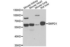 Western blot analysis of extracts of various cell lines, using SMPD1 antibody. (SMPD1 Antikörper  (AA 70-340))