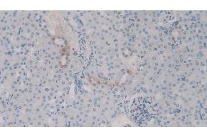 Detection of C4a in Mouse Kidney Tissue using Polyclonal Antibody to Complement Component 4a (C4a) (C4A Antikörper)