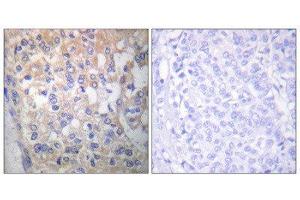 Immunohistochemistry (IHC) image for anti-FYN Oncogene Related To SRC, FGR, YES (FYN) (pTyr530) antibody (ABIN1847258) (FYN Antikörper  (pTyr530))