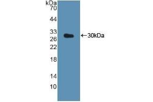 Detection of Recombinant CTSK, Human using Polyclonal Antibody to Cathepsin K (CTSK) (Cathepsin K Antikörper  (AA 54-317))