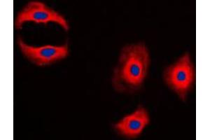 Immunofluorescent analysis of MMP3 staining in A431 cells. (MMP3 Antikörper  (C-Term))