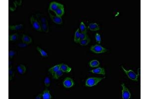 Immunofluorescent analysis of Hela cells using ABIN7165923 at dilution of 1:100 and Alexa Fluor 488-congugated AffiniPure Goat Anti-Rabbit IgG(H+L) (PPP1R12C Antikörper  (Regulatory Subunit 12C))