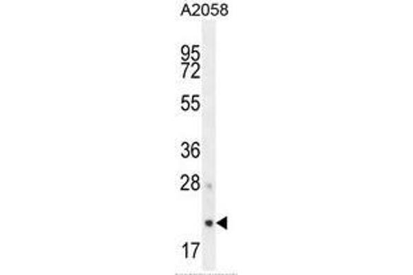 AP3S1 Antikörper  (N-Term)