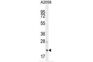 AP3S1 Antibody (N-term) western blot analysis in A2058 cell line lysates (35µg/lane).