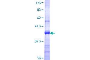 MLKL Protein (AA 371-471) (GST tag)