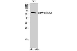 Western Blotting (WB) image for anti-P21-Activated Kinase 1 (PAK1) (pThr212) antibody (ABIN3182552) (PAK1 Antikörper  (pThr212))