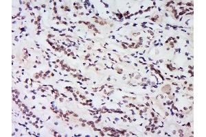 Formalin-fixed and paraffin embedded human kidney labeled with Rabbit Anti-HS1BP3 Polyclonal Antibody, Unconjugated  at 1:200 followed by conjugation to the secondary antibody and DAB staining. (HS1BP3 Antikörper  (AA 51-130))