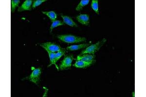 Immunofluorescent analysis of Hela cells using ABIN7154998 at dilution of 1:100 and Alexa Fluor 488-congugated AffiniPure Goat Anti-Rabbit IgG(H+L) (Hemopexin Antikörper  (AA 32-254))