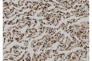 ABIN6264086 and ABIN6279212 at 1/100 staining Human lung tissue by IHC-P. (PDE1A Antikörper  (Internal Region))