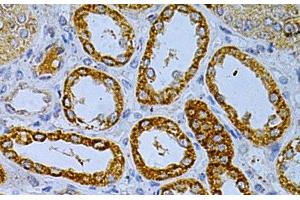 Immunohistochemistry of paraffin-embedded Human kidney using OLR1 Polyclonal Antibody at dilution of 1:200 (40x lens).