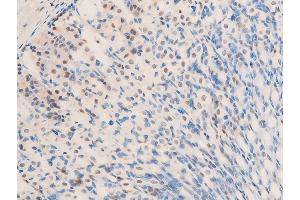 ABIN6267283 at 1/100 staining mouse gastric tissue sections by IHC-P. (ErbB2/Her2 Antikörper  (pTyr1248))