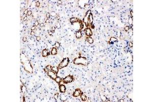 Anti-Glucose Transporter 5 GLUT5 antibody, IHC(P) IHC(P): Rat Kidney Tissue (SLC2A5 Antikörper  (Middle Region))