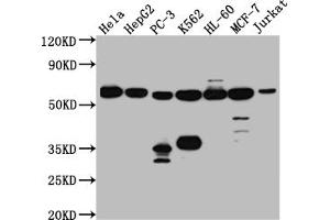 Western Blot Positive WB detected in: Hela whole cell lysate, HepG2 whole cell lysate, PC-3 whole cell lysate, K562 whole cell lysate, HL-60 whole cell lysate, MCF-7 whole cell lysate, Jurkat whole cell lysate All lanes: PTBP1 antibody at 1:1000 Secondary Goat polyclonal to rabbit IgG at 1/50000 dilution Predicted band size: 58, 60, 60 kDa Observed band size: 58 kDa (Rekombinanter PTBP1 Antikörper)