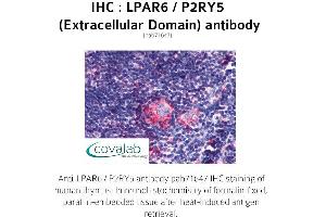Image no. 1 for anti-Lysophosphatidic Acid Receptor 6 (LPAR6) (2nd Extracellular Domain) antibody (ABIN1736531) (LPAR6 Antikörper  (2nd Extracellular Domain))
