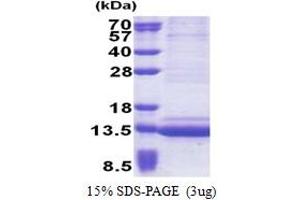 SDS-PAGE (SDS) image for Epithelial Mitogen (EPGN) (AA 23-110) protein (His tag) (ABIN5853246)
