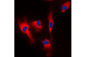 Immunofluorescent analysis of Calmodulin staining in MCF7 cells. (Calmodulin 1 Antikörper  (Center))