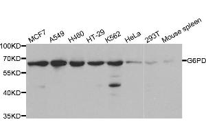 Western blot analysis of extracts of various cell lines, using G6PD antibody. (Glucose-6-Phosphate Dehydrogenase Antikörper)