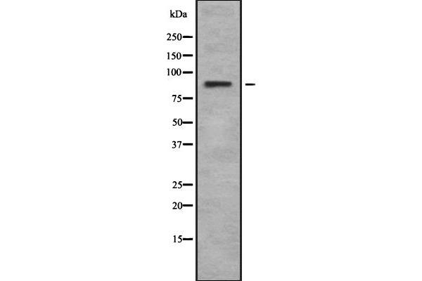 RPS6KA6 antibody  (C-Term)