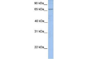 Human MCF-7; WB Suggested Anti-ACSL1 Antibody Titration: 0. (ACSL1 Antikörper  (N-Term))