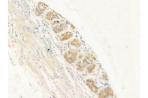 ABIN6256040 and ABIN6267417 at 1/100 staining human normal gastric tissue by IHC-P. (Vinculin Antikörper  (pTyr822))