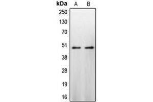 Western blot analysis of Caspase 9 expression in HeLa (A), NIH3T3 (B) whole cell lysates. (Caspase 9 Antikörper  (Center))