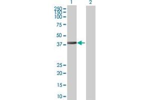Western Blotting (WB) image for anti-DnaJ (Hsp40) Homolog, Subfamily B, Member 6 (DNAJB6) (AA 1-326) antibody (ABIN523418)