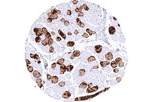 Skeletal muscle of the tongue showing a strong cytoplasmic MYH7 staining of about 40 of muscle cells