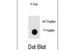 Dot Blot (DB) image for anti-Endophilin (pTyr80) antibody (ABIN3001911) (Endophilin (pTyr80) Antikörper)