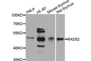 Western blot analysis of extracts of various cell lines, using RAD52 antibody (ABIN5971575) at 1/1000 dilution. (RAD52 Antikörper)