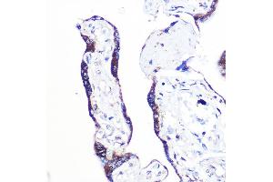 Immunohistochemistry of paraffin-embedded human placenta using PEX2 Rabbit pAb (ABIN7269248) at dilution of 1:100 (40x lens). (PEX2 Antikörper  (AA 1-130))