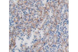 Figure. (LPHN3 Antikörper  (AA 1105-1447))