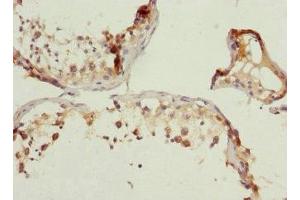 Immunohistochemistry (IHC) image for anti-Wingless-Type MMTV Integration Site Family, Member 5B (WNT5B) (AA 120-359) antibody (ABIN7166308)