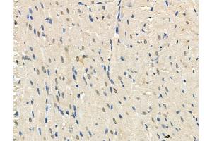 Phospho-TORC2 (Ser275) Antibody at 1/100 staining Rat heart tissue by IHC-P. (CRTC2 Antikörper  (pSer275))