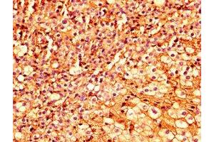IHC image of ABIN7151937 diluted at 1:300 and staining in paraffin-embedded human adrenal gland tissue performed on a Leica BondTM system. (ESRP2 Antikörper  (AA 615-720))