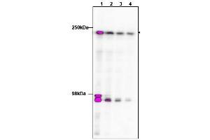 Image no. 1 for anti-TAF1 RNA Polymerase II, TATA Box Binding Protein (TBP)-Associated Factor, 250kDa (TAF1) (C-Term) antibody (ABIN401389) (TAF1 Antikörper  (C-Term))