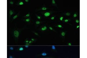 Immunofluorescence analysis of U-2 OS cells using MDC1 Polyclonal Antibody at dilution of 1:100. (MDC1 Antikörper)