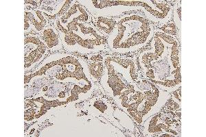 IHC analysis of LPP using anti-LPP antibody (ABIN7599606). (LPP Antikörper  (AA 10-572))