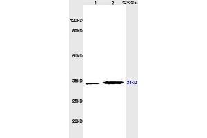 Lane 1: rat brain lysates Lane 2: rat heart lysates probed with Anti CD1A Polyclonal Antibody, Unconjugated (ABIN702700) at 1:200 in 4 °C. (CD1d1 Antikörper  (AA 51-150))