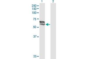 Western Blot analysis of STS expression in transfected 293T cell line by STS MaxPab polyclonal antibody. (STS Antikörper  (AA 1-583))