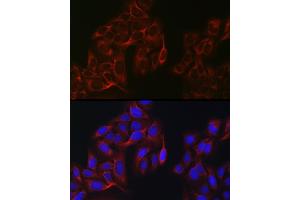 Immunofluorescence analysis of U2OS cells using eIF4 Rabbit pAb (ABIN6129659, ABIN6140076, ABIN6140077 and ABIN6220909) at dilution of 1:100 (40x lens). (EIF4A1 Antikörper  (AA 1-406))